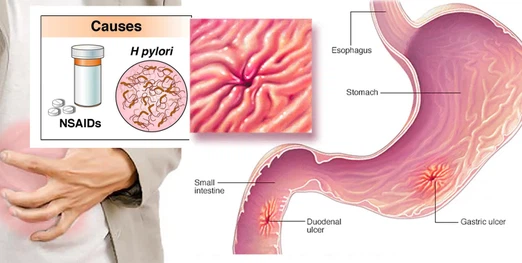 39BPC-157 powder 39BPC-157 powder