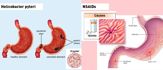 39BPC-157 powder A 39BPC-157 powder A